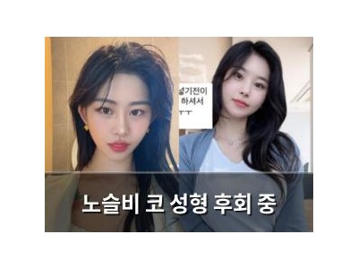 노슬비 코 성형 후회 중